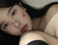 女生被外科男医生检查肛门，觉得难堪心里过不去坎怎么办？